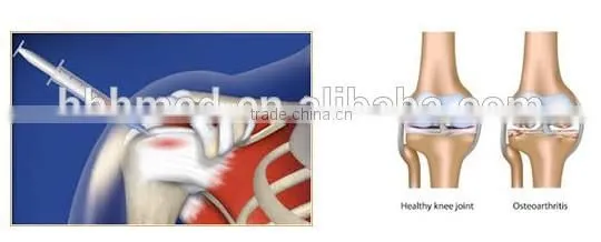 Platelet Rich Plasma PRP Tube photo-6