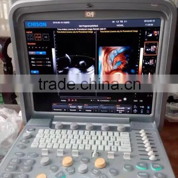 CE ISO Portable/laptop Color Doppler 3D/4D Ultrasound Diagnostic System Machine Clear Image photo-2