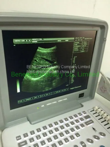 Portable B/W Ultrasound Scanner With Clear Image Quality Hospital Equipment photo-2