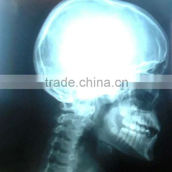 Medical Accessories Wholesale Fujifilm Instax Film With CE License and Iso13485