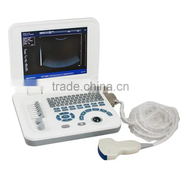 New Laptop Ultrasound Scanner Ultrasonic Diagnostic System RUS-9000F2 photo-2