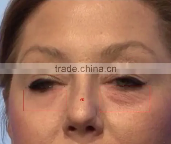 50 Sachets AGELESS Eye Cream US Instantly Face Lift Anti Aging Skin Care Products Wrinkle photo-6