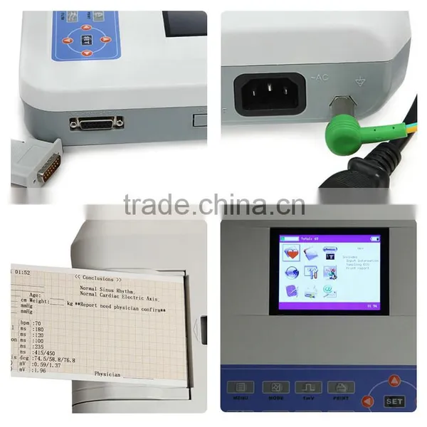 CE and ISO13485 White Color High Resolution TFT Color LCD Portable Digital 3-channel Electrocardiograph photo-6