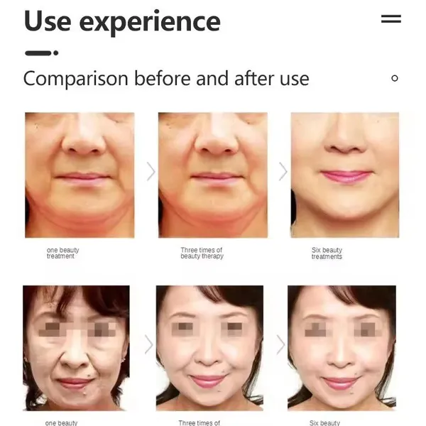 2 in 1 Ice Sculpture Facial Lifting Wrinkles Removal Skin Tightening Device for Salon photo-4