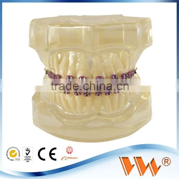 High Quality 4.5 LCD Root Canal Treatment photo-6