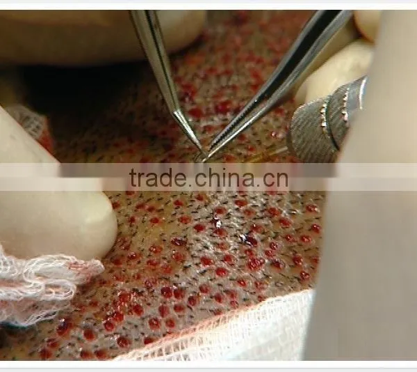 TRANSPLANTATION FORCEPS photo-5