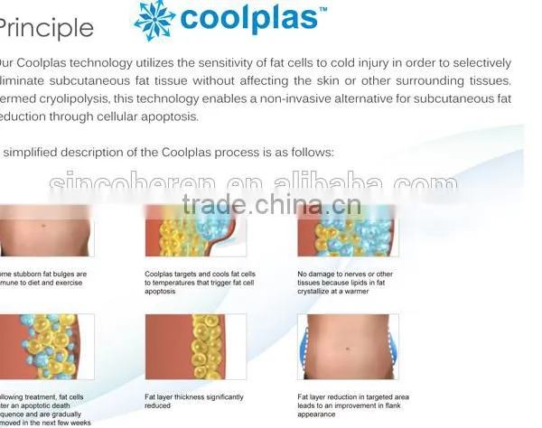 2015 Hot New Cryolipolysie Fat Freezing Slimming Weight Loss Machine With 3 Heads Best Cryolipolysie Fat Freezing Zeltiq photo-5