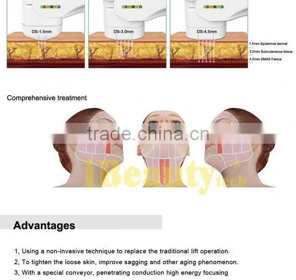 Beautiful Good Hifu Ultrasound photo-5