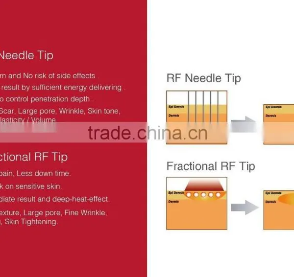 2015 Anti-aging Standing Micro-needle Fractional rf photo-2