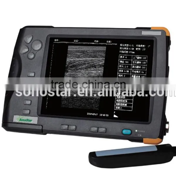 Sonostar Portable Cow Ultrasound Machine Pig Pregnancy Ultrasound Scanner Pirce V5 photo-5