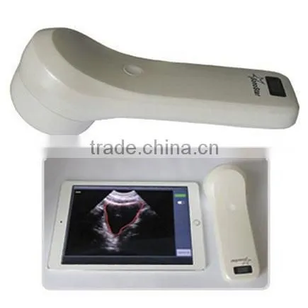 Sonostar New 3D 4D Laptop Ultrasound Scanner Ipad Ultrasound Scanner for Sale BProbe-2 photo-3