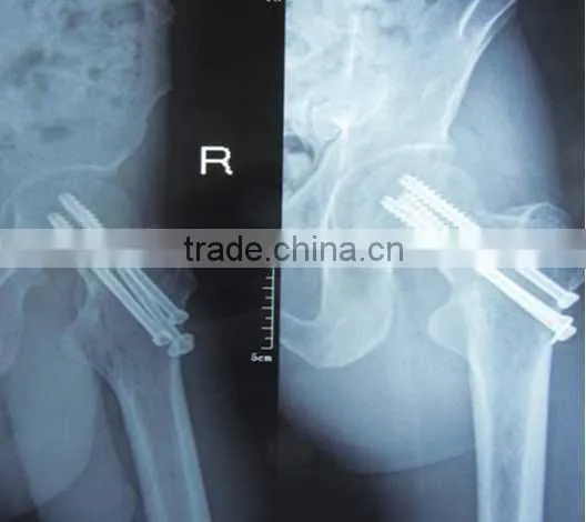 China Radiografias Extraorales Film KND-A/F CE