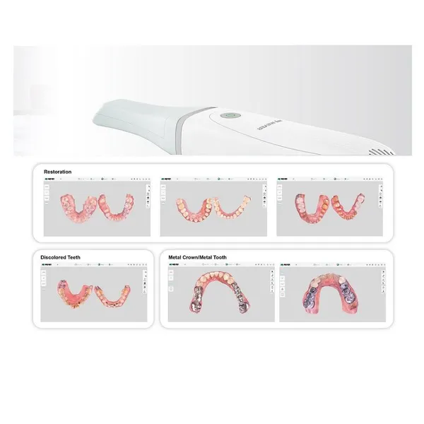 Intraoral Scanner photo-4