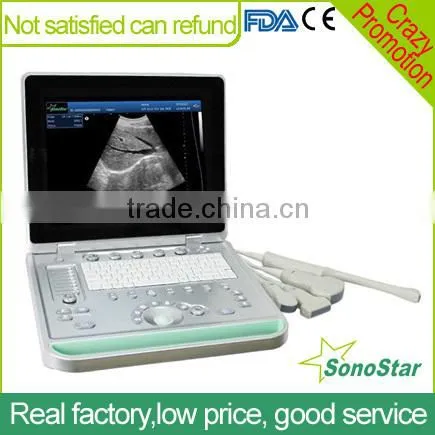 Sonostar Hospital Veterinary Equipment B Model Ultrasound Machine for Sale V9