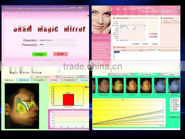 3D Intelligent Skin Analyzer Machine Best Selling Skin Analyzing Equipment photo-2