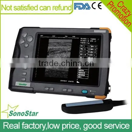 Sonostar Portable Cow Ultrasound Machine Pig Pregnancy Ultrasound Scanner Pirce V5