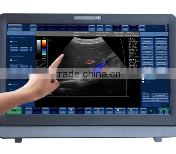 Medical Color Doppler Ultrasound Diagnostic System, Color Doppler Ultrasound