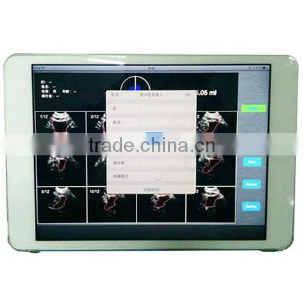 Sonostar New 3D 4D Laptop Ultrasound Scanner Ipad Ultrasound Scanner for Sale BProbe-2 photo-4