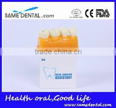 Pit and Fissure Model Dental Eduction Assitant No. DEA-19 photo-4