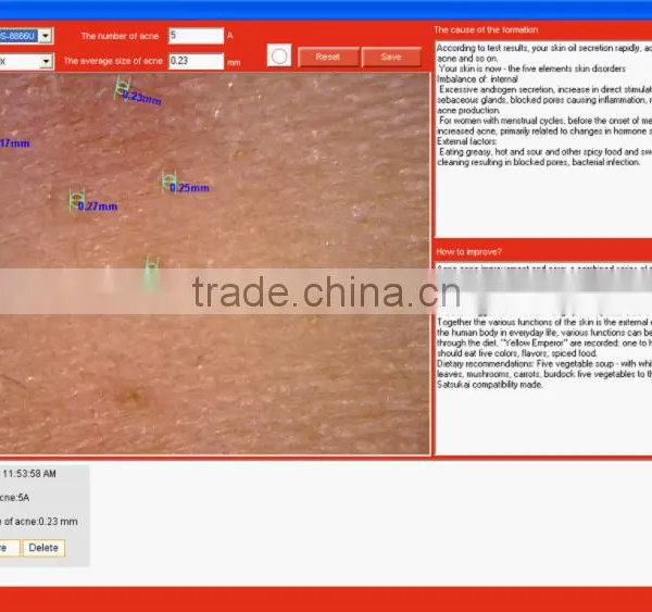 Professional Clinic Use Face Skin Analysis Equipment With FCC/CE Approval photo-3