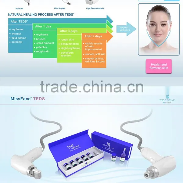 Effective Results!! Portable Ultrasound rf Wrinkle Removal photo-3