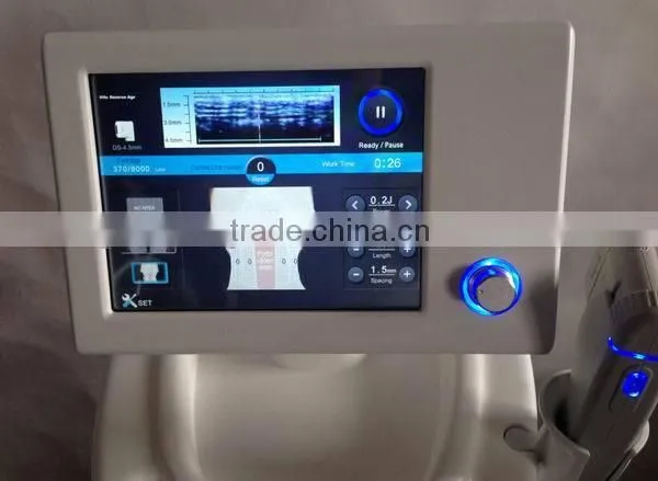 Wrinkle Remover Feature High Intensity Focused Ultrasound Hifu photo-4