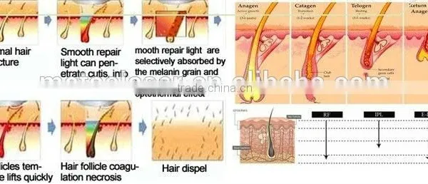 Manufacture HIFRF Beauty Machine Radio Frequency Aesthetics photo-4