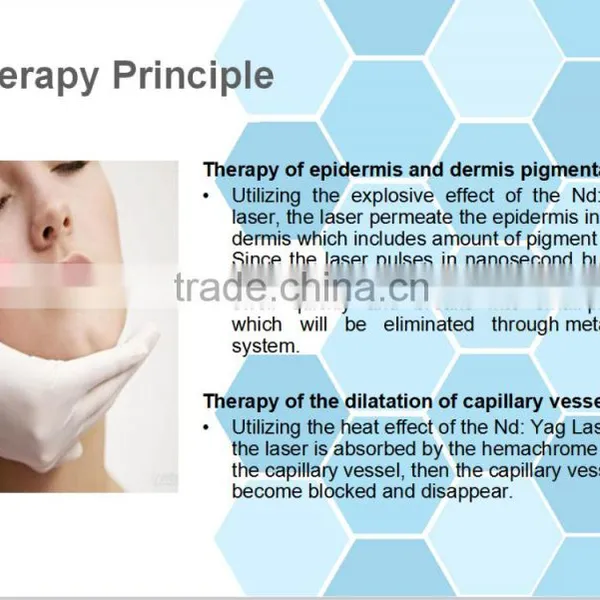 Beauty Best Medical Use Q-switched nd Yag Laser for Tattoo Removal/medical Laser nd Yag/yag Laser Tattoo Removal photo-6