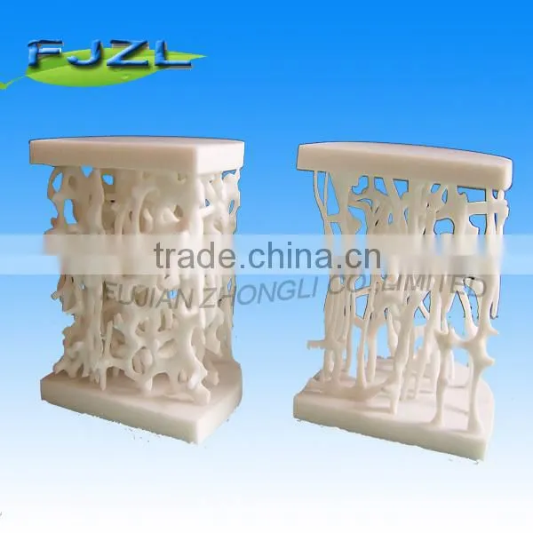 Osteoporosis Model photo-2