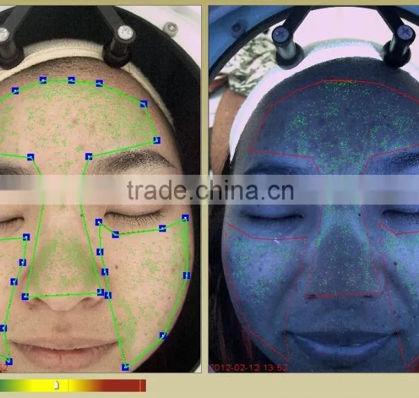 2016 Most Popular Skin Analyzer Skin Scope Machine Magic Mirror Skin Analyzer photo-3