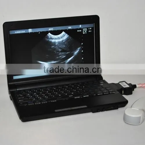 Full Digital Laptop Ultrasound Scanner RUS-9000F Optional Convex Probe Endocavity photo-3