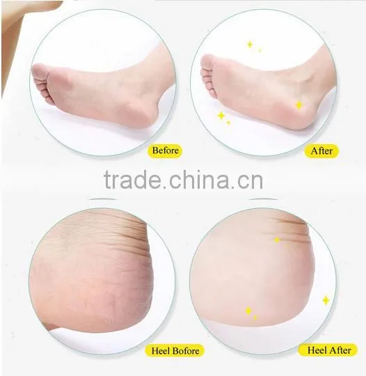 Battery Operated Manicure Kits/foot Skin Removal Tool Buy 1 Device 4 Pcs for Free photo-4