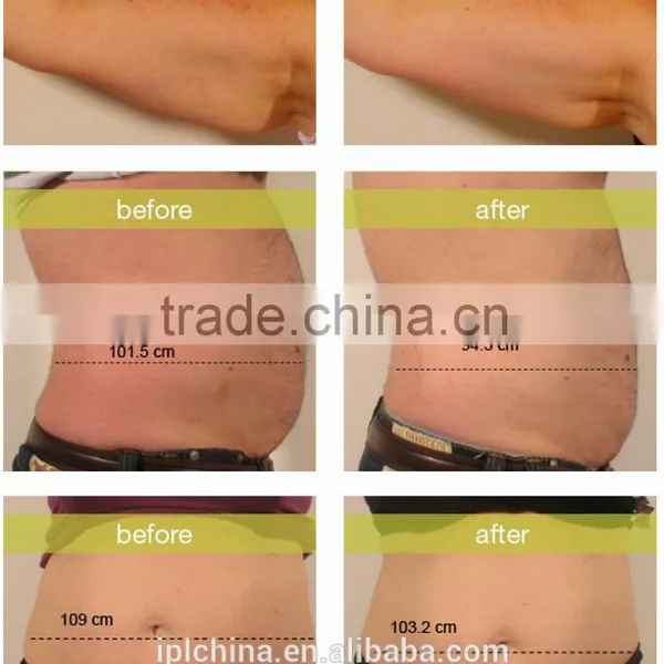 2015 New Hot PEMF & RF Body Sliming Salon Machine - CE photo-6