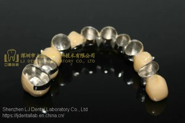 Dental Crown Composite, Dental Teeth, Dental Prosthesis, Laboratoire Dentaire, Dentallabor, Laboratorio Dental, Dental Laboratory, Shenzhen LJ Dental Lab China photo-5