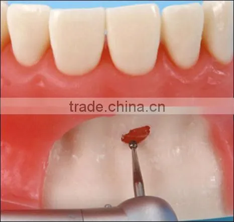 Oral Surgery Jaw Model photo-3