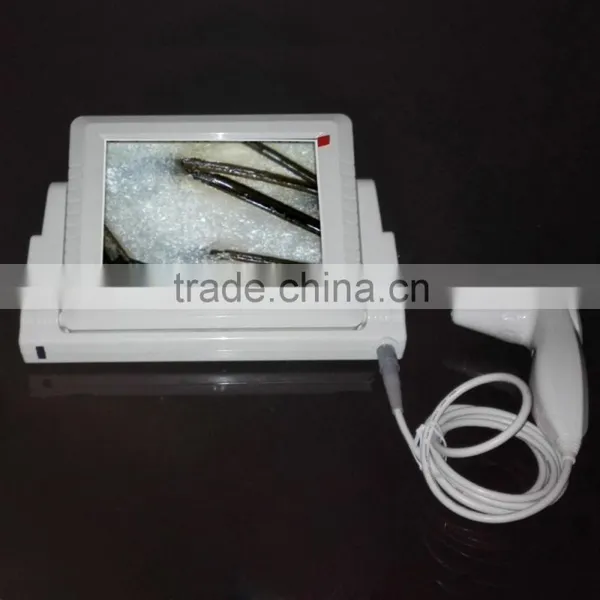 Hot in INDIA Skin and Hair Analyzer Machine photo-2