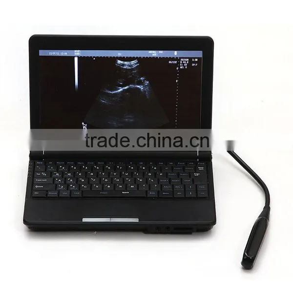 Cheap Portable Ultrasound ce Approved Veterinary Use Full Digital Ultrasound Scanner photo-2