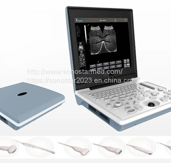 SS-6B Laptop All-Digital Ultrasound photo-3