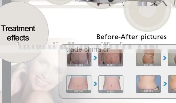 Lipolaser Slimming Machine photo-2