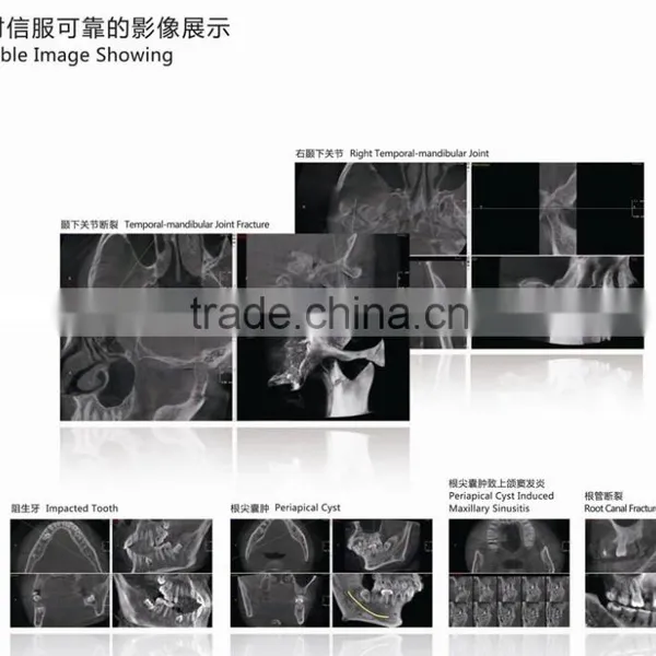 Digital 3D Intra-oral Imaging X-ray Machine photo-6