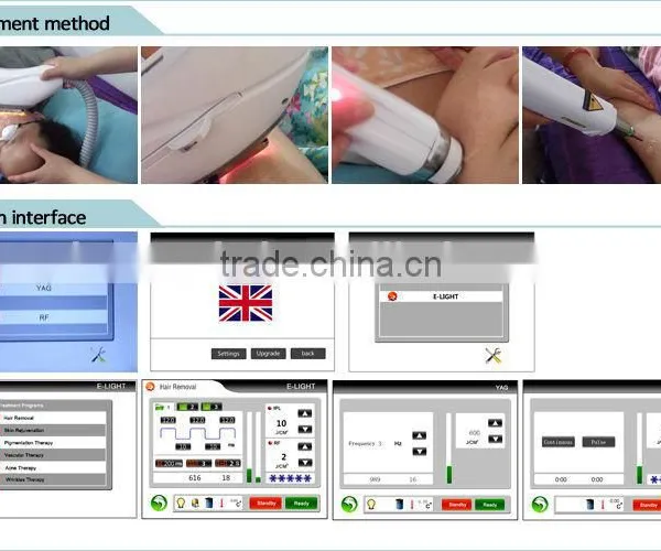 Multifunction Beauty Equipment Long Pulse Laser Elight Tattoo Removal System Rf Nd Yag Laser Mongolian Spots Removal photo-6