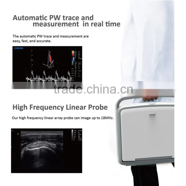 2016 Laptop/Portable 3D 4D Ultrasound Machine Color Doppler Diagnostic System photo-3