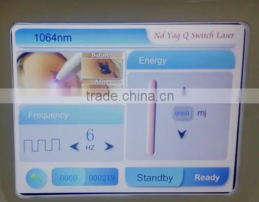 Laser Tattoo Removal Black Face Tattoo Removal System /Tattoo Removal Laser photo-3
