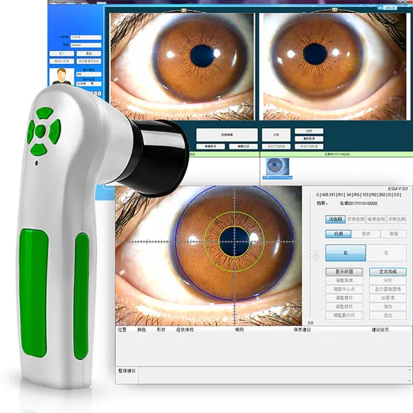 Digital Iriscope 12mp Iridology Camera Eye Iriscope Camera Analyzer photo-3