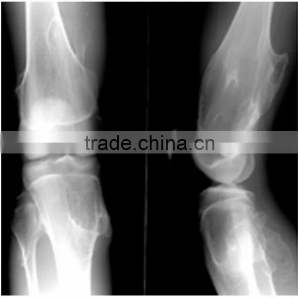 High Tech Laser Printer Medical Dry Film