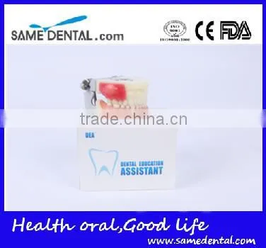 Abscess and Tooth Preparation Model School Teaching Demonstration photo-5