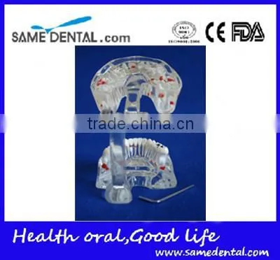 Dental Adult Pathological Dentition Model DEA-48 Teeth Model Teaching Demonstration photo-4
