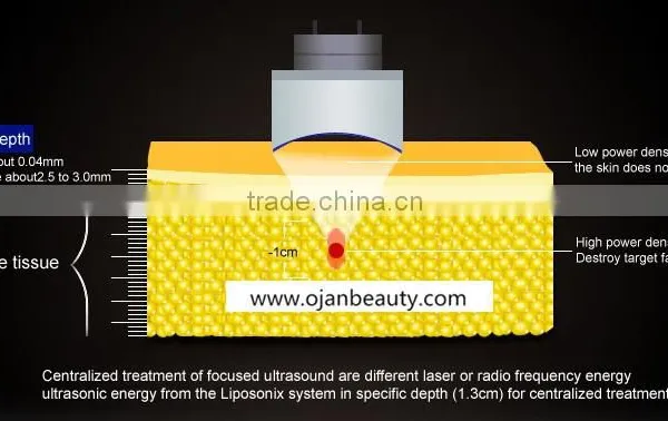 2016 Hottest Slimming Machine Liposunix With 8mm and 13mm photo-6