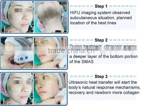 2016 Factory Price China Medical Hifu for Wrinkle Removal/hifu for Skin Tighting photo-5