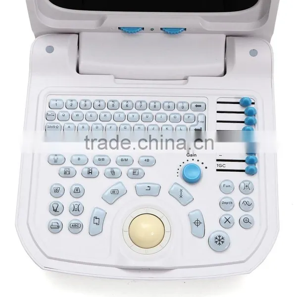 CE Approved Portable PC Ultrasound Scanner/Ultrasound Machine With 3.5Mhz Multi-frequency Convex Probe RUS-9000A photo-2